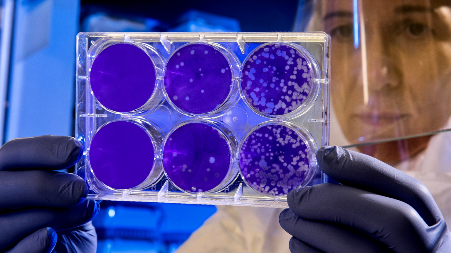 a Virus Fighter Learn how to increase your Natural Killer Cells